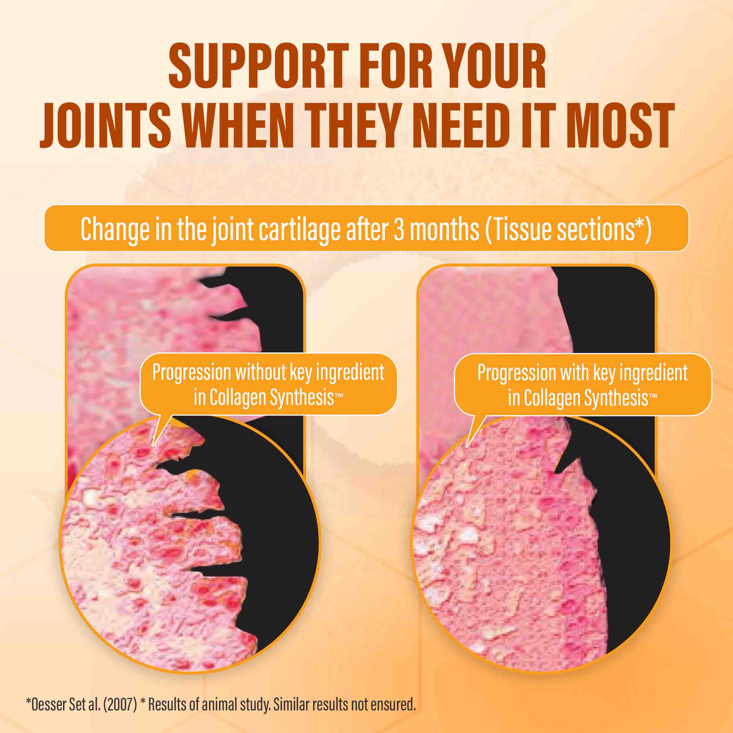 COLLAGEN SYNTHESIS - Collagen Peptides for Tendon, Ligament, & Cartilage Support - Image 5